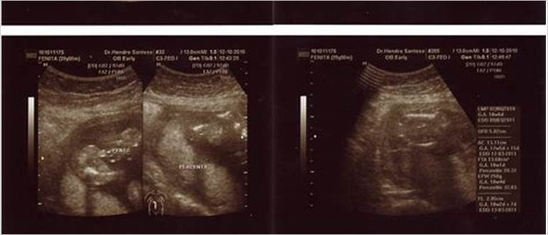 19 week 4d ultrasound